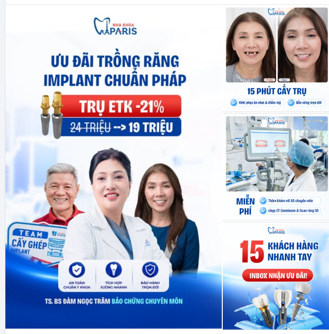 ƯU ĐÃI TRỒNG RĂNG IMPLANT CHUẨN PHÁP – TIẾT KIỆM ĐẾN 5 TRIỆU/TRỤ ETK