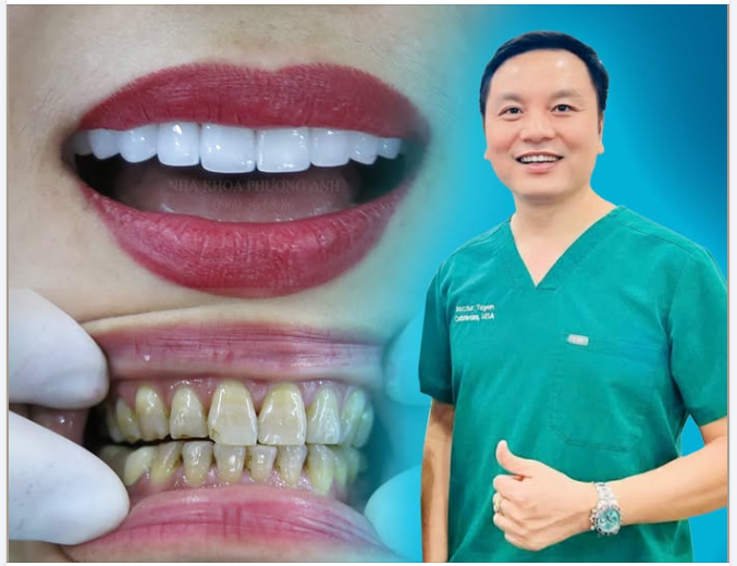 Một ví dụ rất mẫu mực