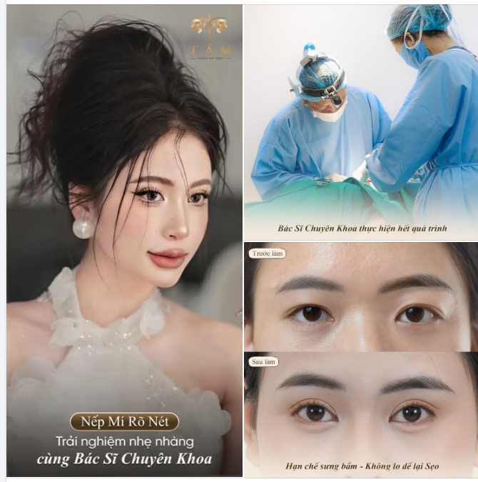 NẾP MÍ RÕ NÉT - TRẢI NGHIỆM NHẸ NHÀNG CÙNG BÁC SĨ CHUYÊN KHOA
