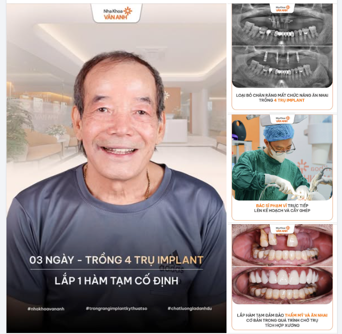 TÌM HIỂU QUA A.I - TRÍ TUỆ NHÂN TẠO, ĐỌC NHIỀU NGUỒN RỒI MỚI QUYẾT ĐỊNH TRỒNG RĂNG