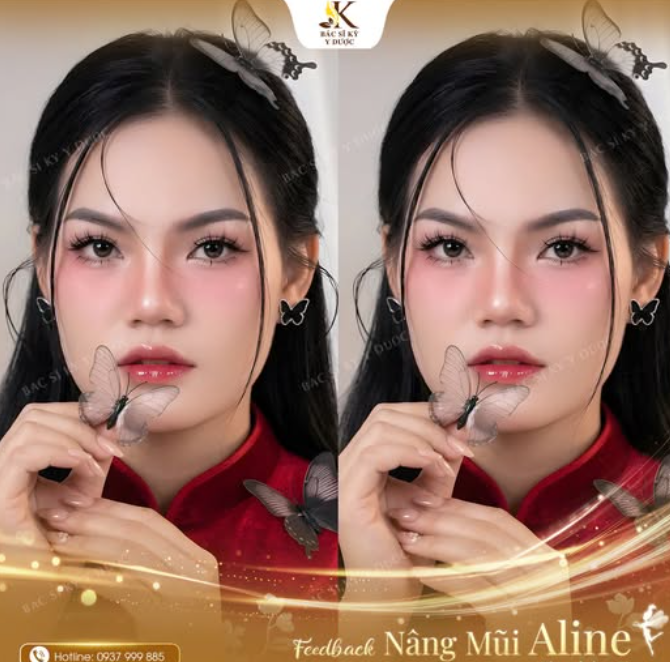 Một dáng mũi hài hòa có thể thay đổi cả diện mạo của bạn