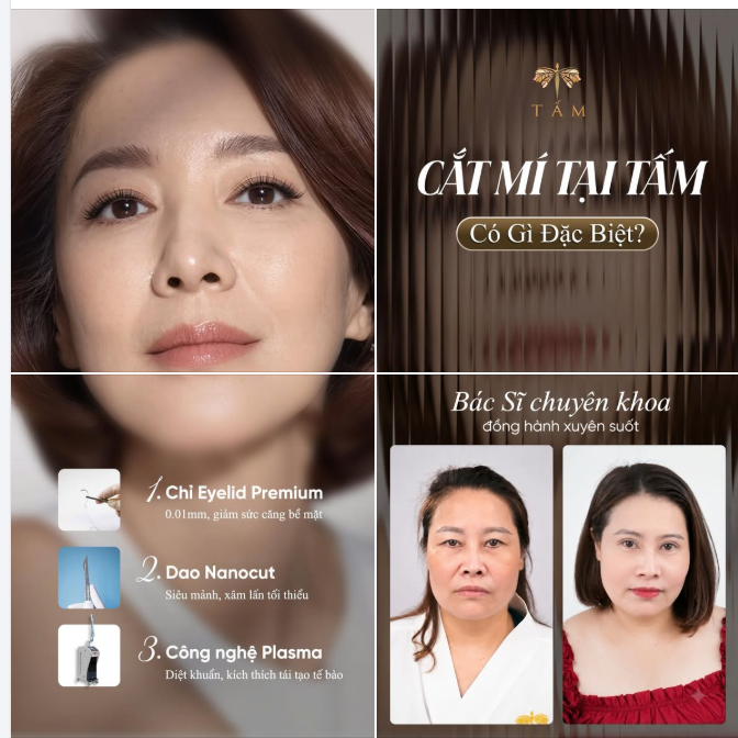 CẮT MÍ KHÔNG S.Ẹ.O TẠI TẤM CÓ GÌ ĐẶC BIỆT?