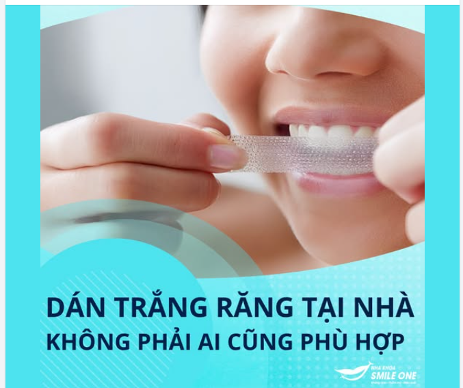 MIẾNG DÁN TRẮNG RĂNG: TIỆN NHƯNG KHÔNG PHẢI AI CŨNG PHÙ HỢP
