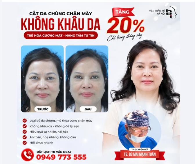 CẮT CHÙNG DA CHÂN MÀY: XOÁ SỤP MÍ LÃO HÓA – KIẾN TẠO TƯỚNG MẠO PHÚ QUÝ