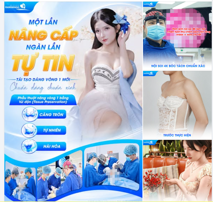 MỘT LẦN NÂNG CẤP, NGÀN LẦN TỰ TIN - TÁI TẠO DÁNG VÒNG 1 MỚI, CHUẨN DÁNG CHUẨN XINH