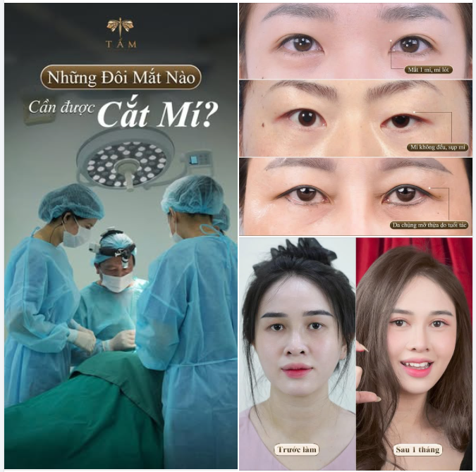 Có những đôi mắt đẹp sẵn — chỉ cần thay đổi một chút để hoàn hảo: