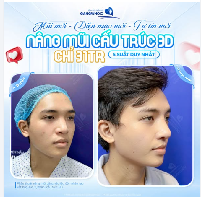 MŨI MỚI - DIỆN MẠO MỚI - TỰ TIN MỚI