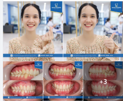 Hơn 2 năm cho nụ cười này, nhìn Hồng Huế là biết xứng đáng đến từng phút giây