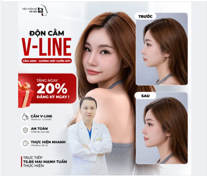 ĐỘN CẰM VLINE - GÓC NGHIÊNG THẦN TIÊN