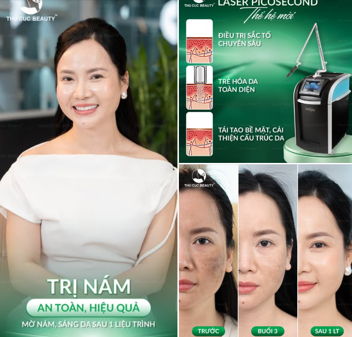 TRỊ NÁM LASER CHUYÊN SÂU: HỖ TRỢ LÀM MỜ HẮC SẮC TỐ