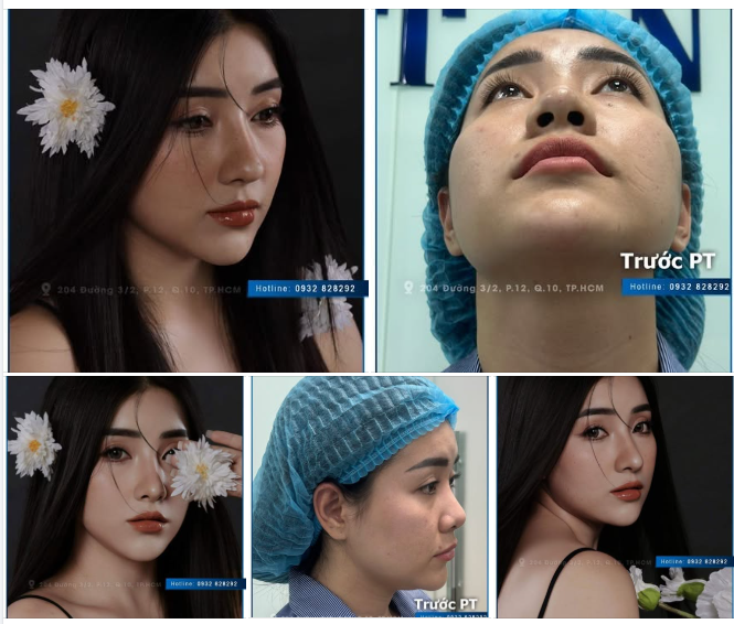 Chỉ cần nghiêng nhẹ cũng đủ làm người ta ngoái nhìn