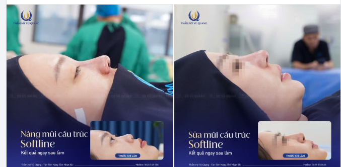 Thay đổi dáng mũi, thăng hạng nhan sắc để tự tin tỏa sáng mọi lúc mọi nơi.