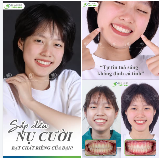 SẮP ĐỀU NỤ CƯỜI, BẬT CHẤT RIÊNG BẠN