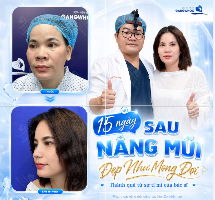 𝐌𝐎̣̂𝐓 𝐃𝐀́𝐍𝐆 𝐌𝐔̃𝐈 Đ𝐄̣𝐏 𝐁𝐀̆́𝐓 Đ𝐀̂̀𝐔 𝐓𝐔̛̀ 𝐓𝐔̛̣ 𝐓𝐈̉ 𝐌𝐈̉ 𝐂𝐔̉𝐀 𝐁𝐀́𝐂 𝐒𝐈̃