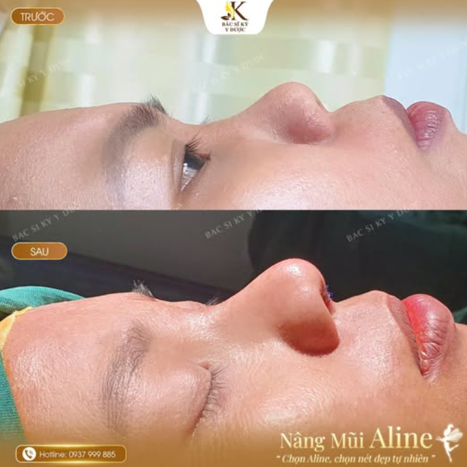 Góc nghiêng không biết nói dối