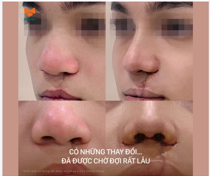 Có những thay đổi… đã được mong đợi rất lâu.