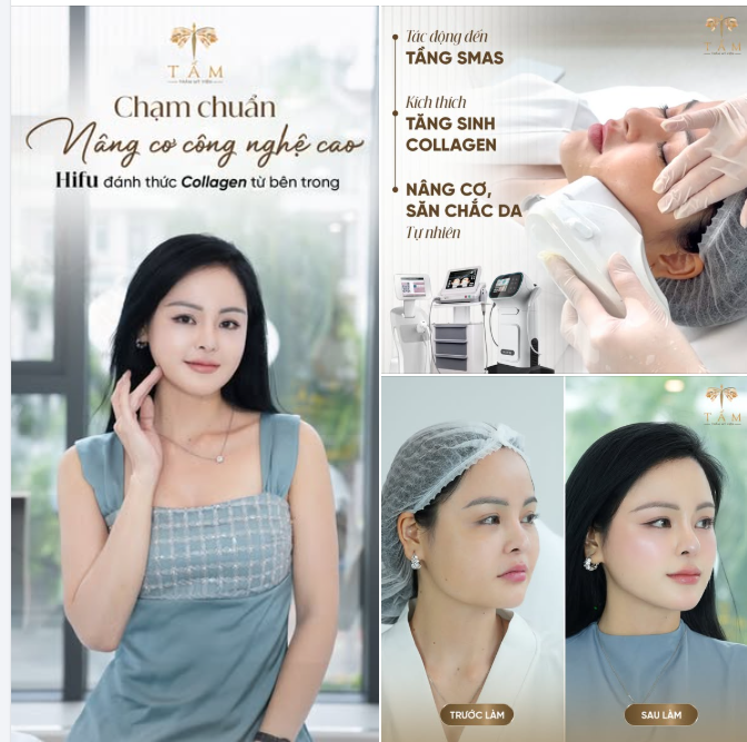 Sức mạnh của công nghệ nâng cơ hiện đại chỉ sau 1 lần thực hiện.