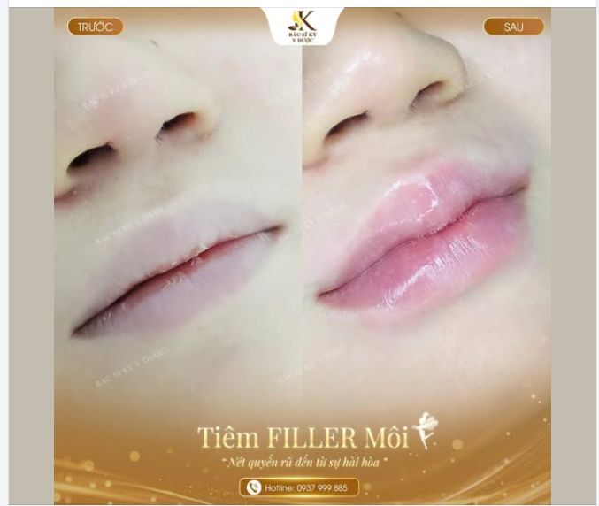 Mới thoa son bóng thôi mà môi căng mọng vậy?