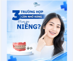3 TRƯỜNG HỢP CẦN NHỔ RĂNG TRƯỚC KHI NIỀNG