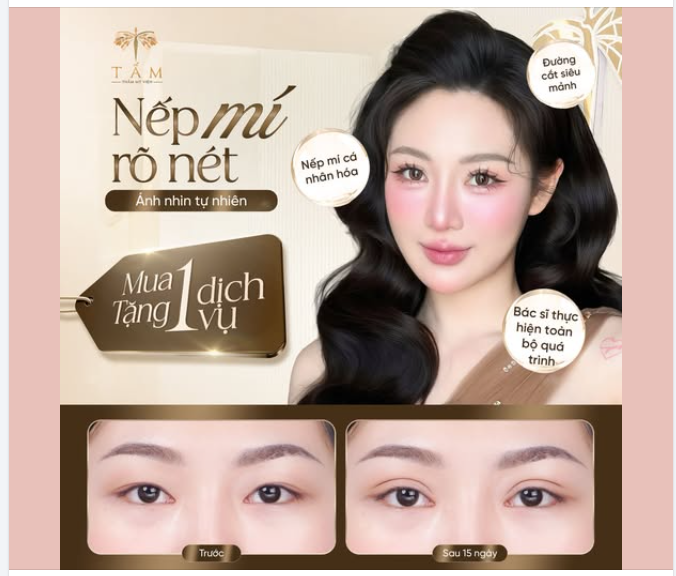 Nếp mí rõ nét - Ánh nhìn tự nhiên
