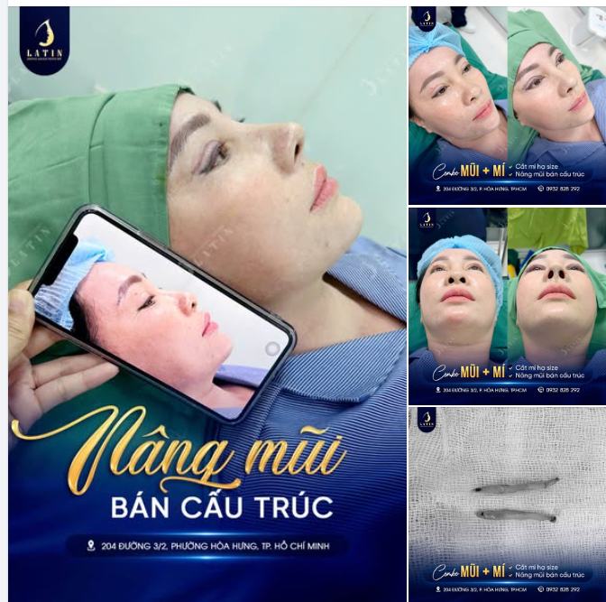 Không phải ai cũng cần thay đổi thật nhiều để đẹp hơn.