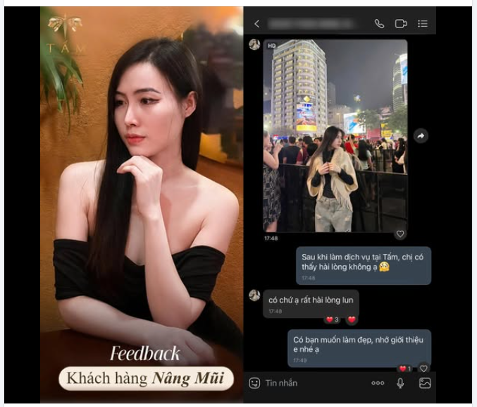 Feedback đầy ưng ý của chị H sau khi thực hiện Nâng mũi tại Tấm.