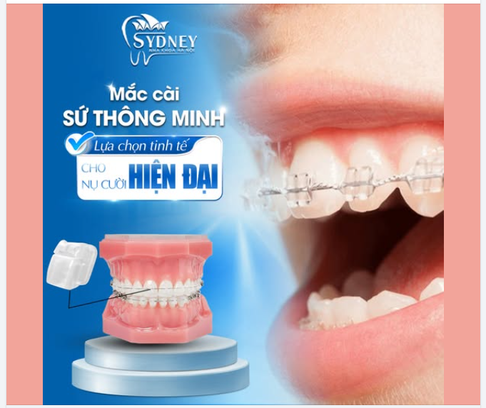 MẮC CÀI SỨ THÔNG MINH - LỰA CHỌN TINH TẾ CHO NỤ CƯỜI HIỆN ĐẠI