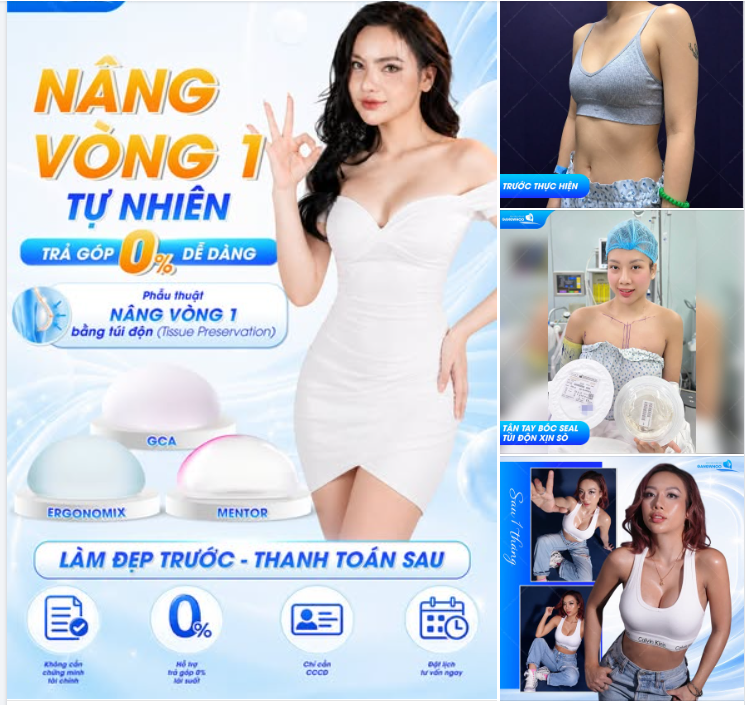 NÂNG VÒNG 1 TỰ NHIÊN - TRẢ GÓP 0% DỄ DÀNG