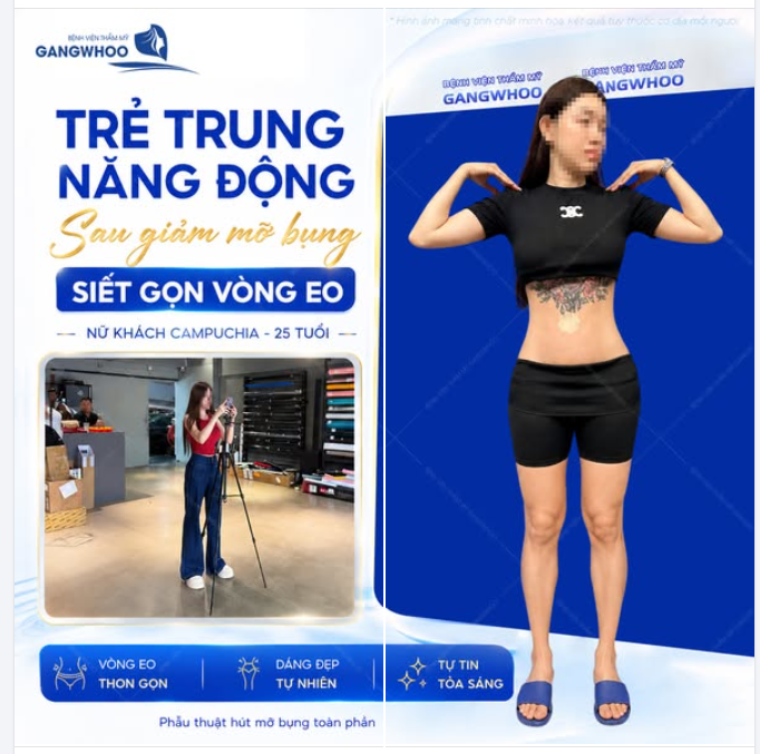 TRẺ TRUNG NĂNG ĐỘNG SAU SIẾT GỌN VÒNG EO