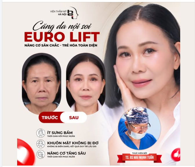 CĂNG DA NỘI SOI EURO LIFT