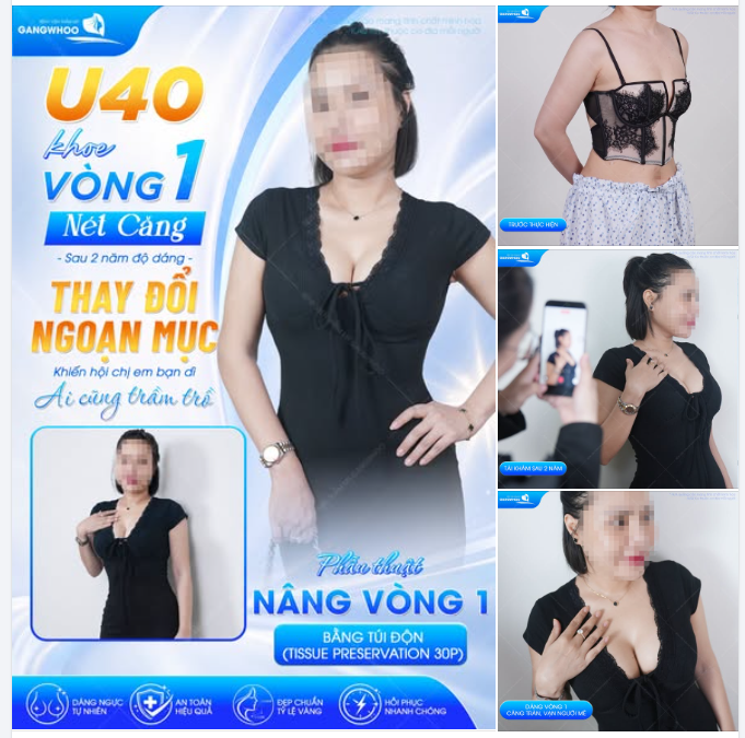 U40 KHOE VÒNG 1 NÉT CĂNG , SAU 2 NĂM ĐỘ DÁNG - THAY ĐỔI NGOẠN MỤC KHIẾN HỘI CHỊ EM BẠN DÌ AI CŨNG TRẦM TRỒ