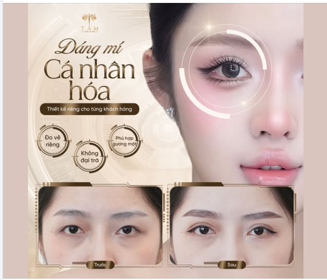 Đôi mắt đẹp không đến từ một dáng mí "theo trend".