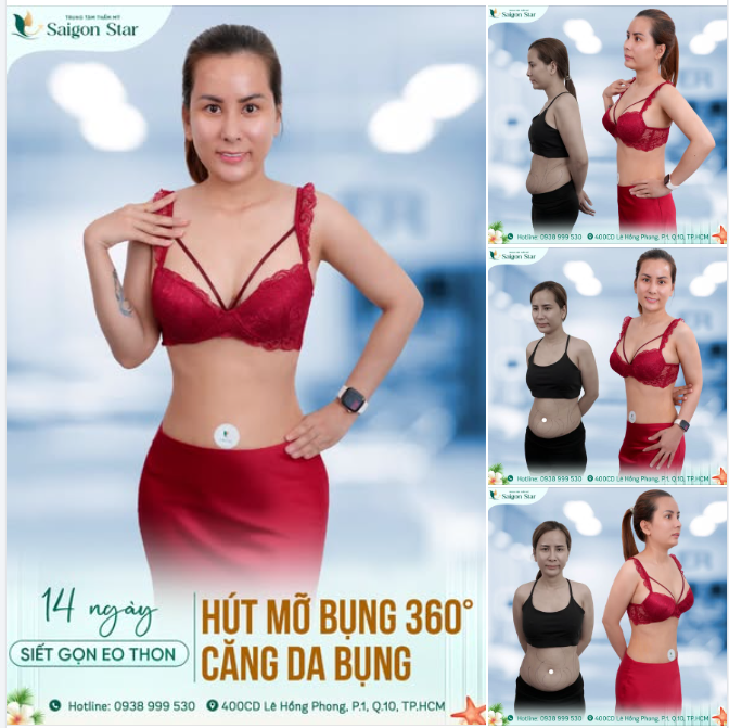 Vòng eo nhiều mỡ thừa khiến chị Diễm Kiều luôn chọn những bộ đồ rộng để che đi khuyết điểm.