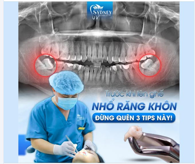 TRƯỚC KHI LÊN GHẾ NHỔ RĂNG KHÔN ĐỪNG QUÊN 3 TIPS NÀY!
