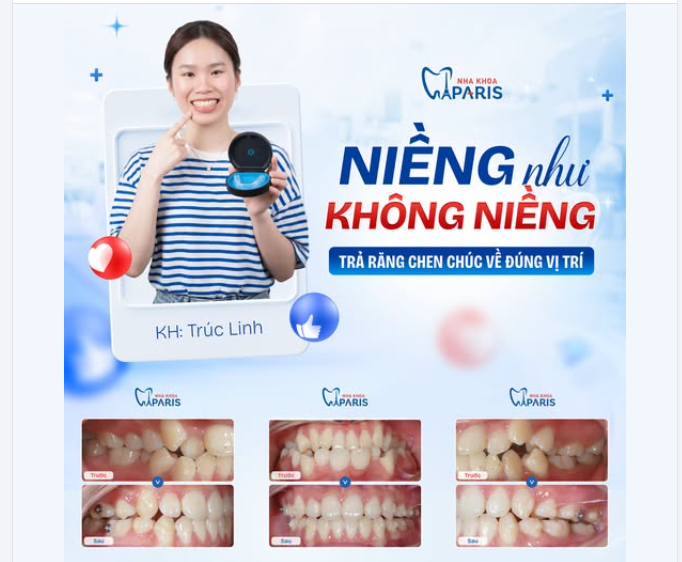 BẠN CÓ DÁM TIN: HÀM RĂNG CHEN CHÚC NẶNG CŨNG CÓ THỂ ĐỀU TĂM TẮP SAU 1 LỘ TRÌNH NIỀNG KHAY TRONG?