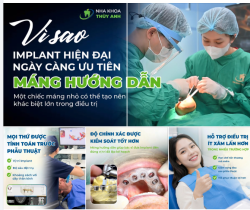 VÌ SAO MÁNG HƯỚNG DẪN NGÀY CÀNG TRỞ THÀNH MỘT PHẦN QUAN TRỌNG TRONG CẤY GHÉP IMPLANT HIỆN ĐẠI?