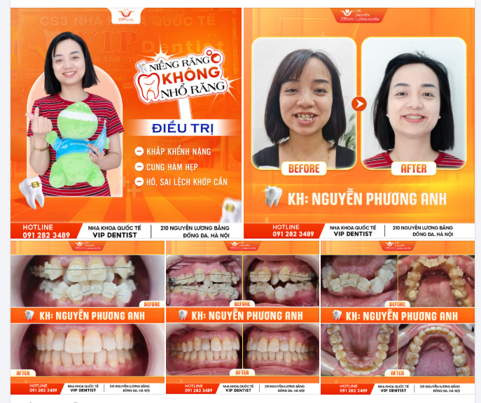 KHÔNG THỂ TIN ĐƯỢC VÀO KẾT QUẢ NÀY!