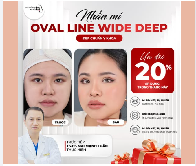 NHẤN MÍ OVAL LINE WIDE DEEP: KIẾN TẠO MẮT ĐẸP SẮC NÉT – KHAI MỞ CUNG TÀI LỘC