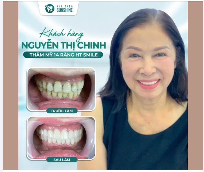 "Có một điều tôi luôn tin rằng: Tuổi tác có thể làm mái tóc bạc đi, nhưng không bao giờ là lý do để từ bỏ một nụ cười đẹp."