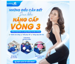 NHỮNG ĐIỀU CẦN BIẾT SAU KHI NÂNG CẤP VÒNG 3