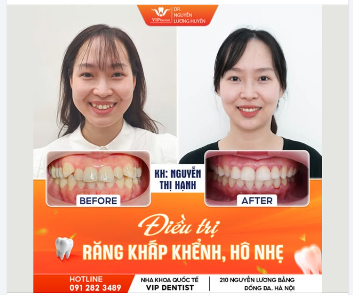 CUNG CƯỜI HOÀN HẢO - TỎA SÁNG MỌI KHUNG HÌNH