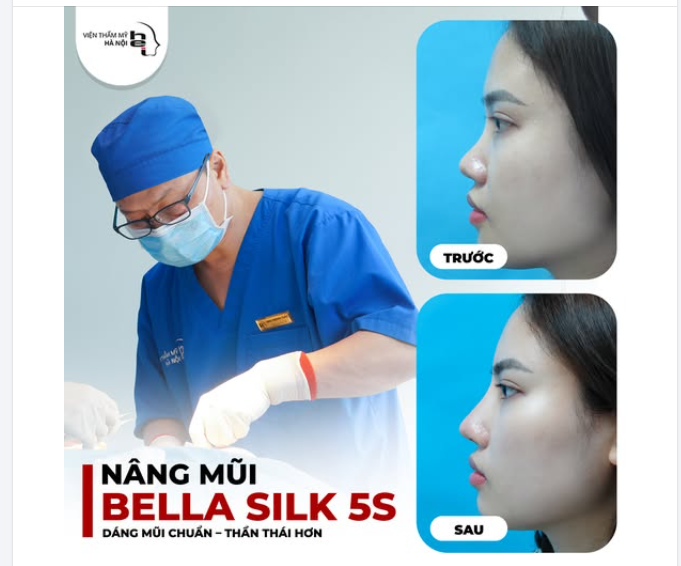 NÂNG MŨI BELLA SILK 5S  Kiến tạo dáng mũi hài hòa – Tôn lên thần thái riêng