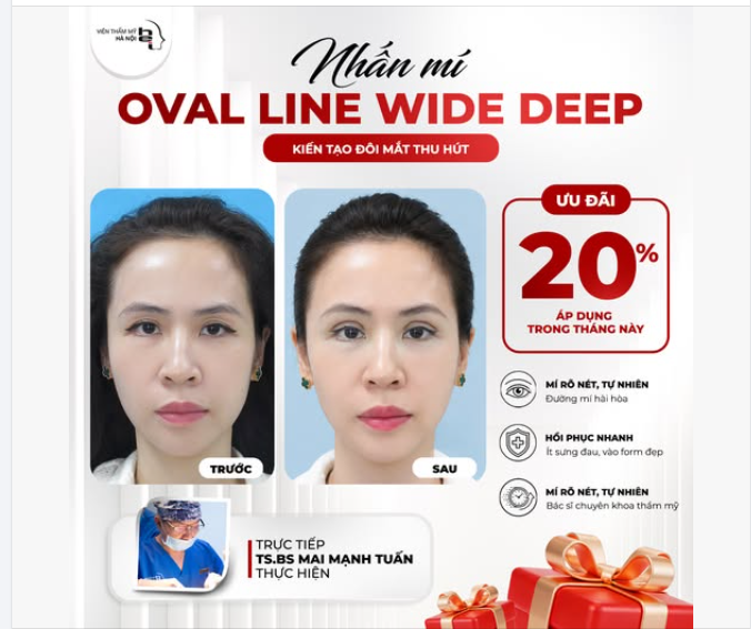 Mắt sang chảnh, dáng mí cao – Thần thái đỉnh cao, mở mang tài lộc