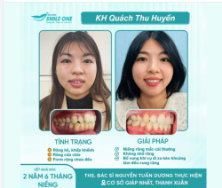 CHÚC MỪNG QUÁCH THU HUYỀN CHÍNH THỨC THÁO NIỀNG!