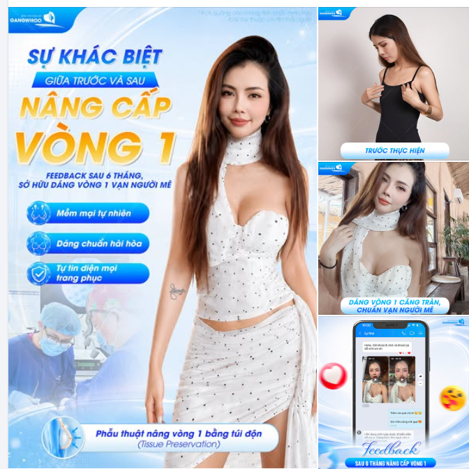 SỰ KHÁC BIỆT GIỮA TRƯỚC VÀ SAU NÂNG CẤP VÒNG 1 - FEEDBACK SAU 6 THÁNG, SỞ HỮU DÁNG VÒNG 1 VẠN NGƯỜI MÊ