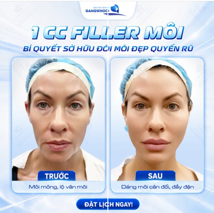 TẠO HÌNH ĐÔI MÔI QUYẾN RŨ, ĐẸP TỰ NHIÊN