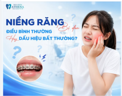 CẢM GIÁC Ê ẨM KHI NIỀNG RĂNG – BÌNH THƯỜNG HAY BẤT THƯỜNG?