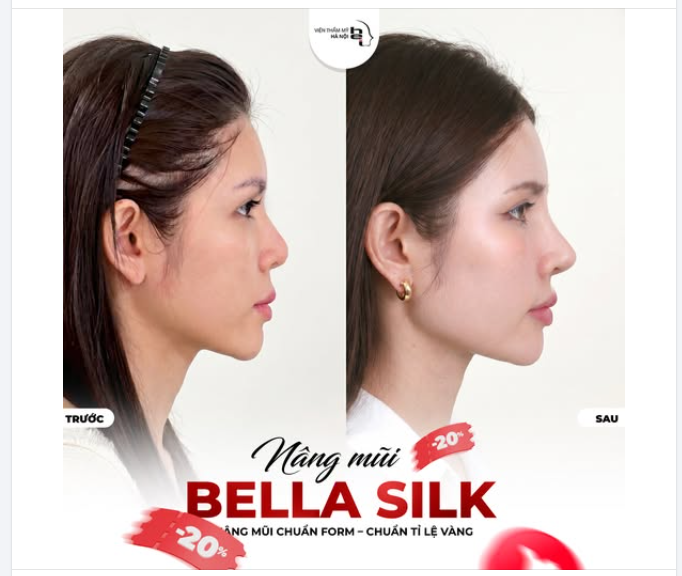 GÓC NGHIÊNG THẦN THÁNH CHỈ SAU 45 PHÚT VỚI BELLA SILK 5S