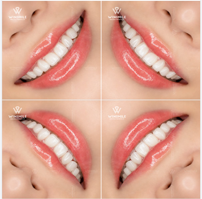 Chúng ta thường dễ bị choáng ngợp bởi những thứ lấp lánh, sắc lạnh nhưng lại dễ gắn bó và cảm mến những điều dịu dàng, ấm áp.