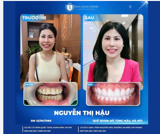 U40 KHÔNG PHẢI LÀ ĐIỂM DỪNG.....